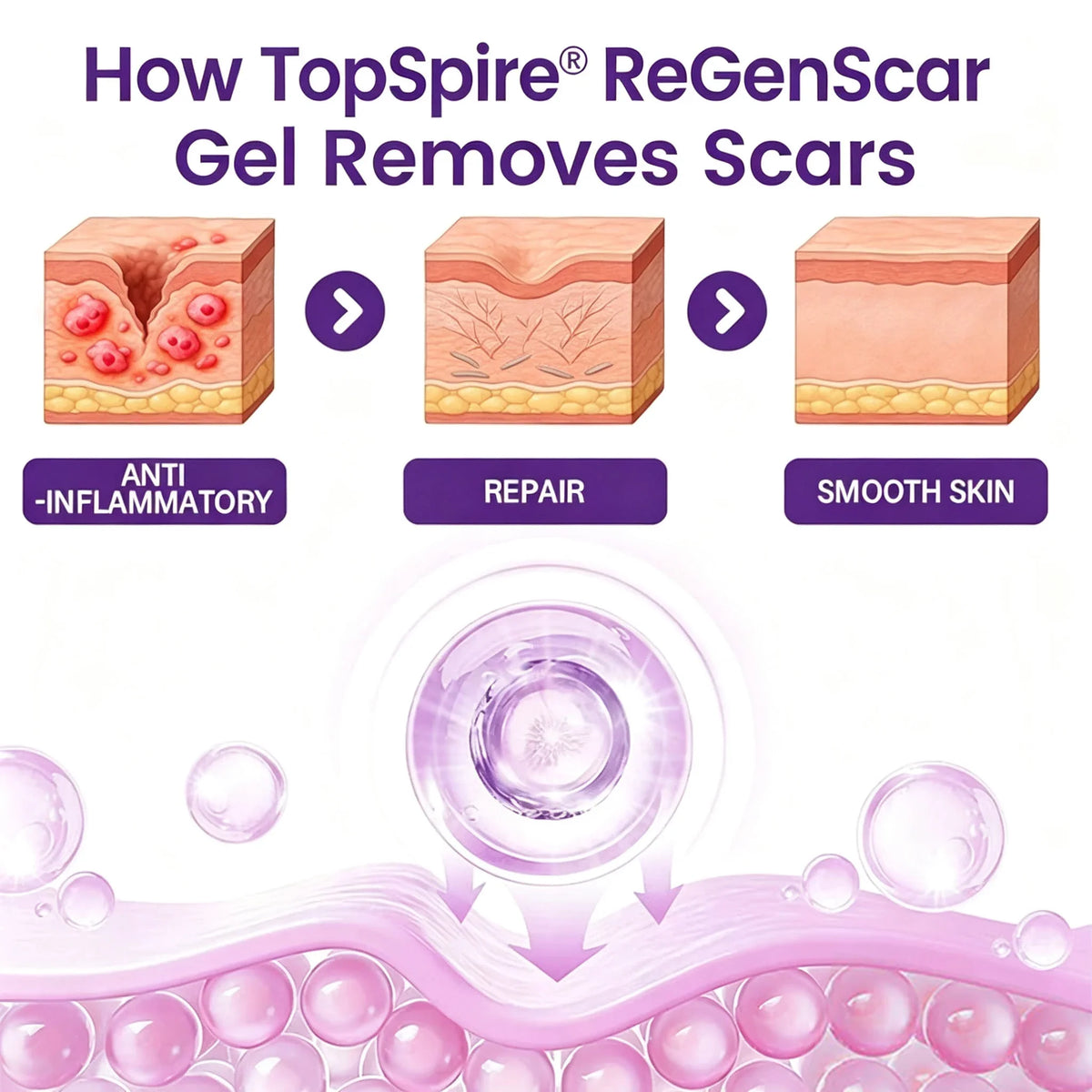 š„TopSpireĀ® ReGenScar Stem Cell Scar Gel