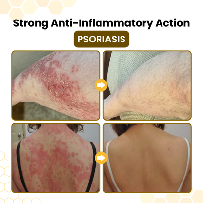 Timlk® Bee Venom Skin-Restoration Cream
