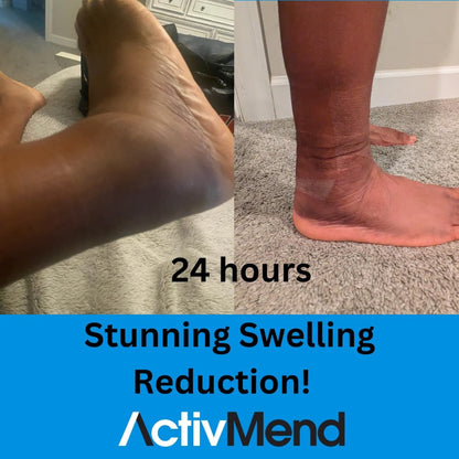 Ankle Sprain Recovery Patches – Helps Speed Up Ankle Sprain Healing & Reduce Swelling Fast | High-Potency Arnica Gel Relief Patch | 5 Patches
